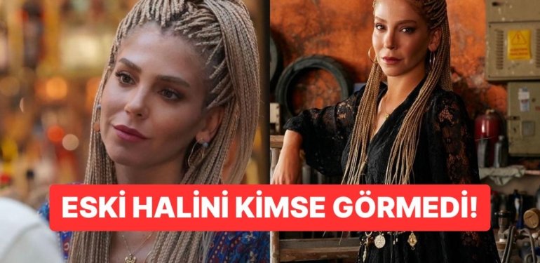 Şahane Hayatım’ın Didem’i Gökçe Eyüboğlu’nun Yalan Dünya’daki Estetiksiz Hali Şoke Etti!