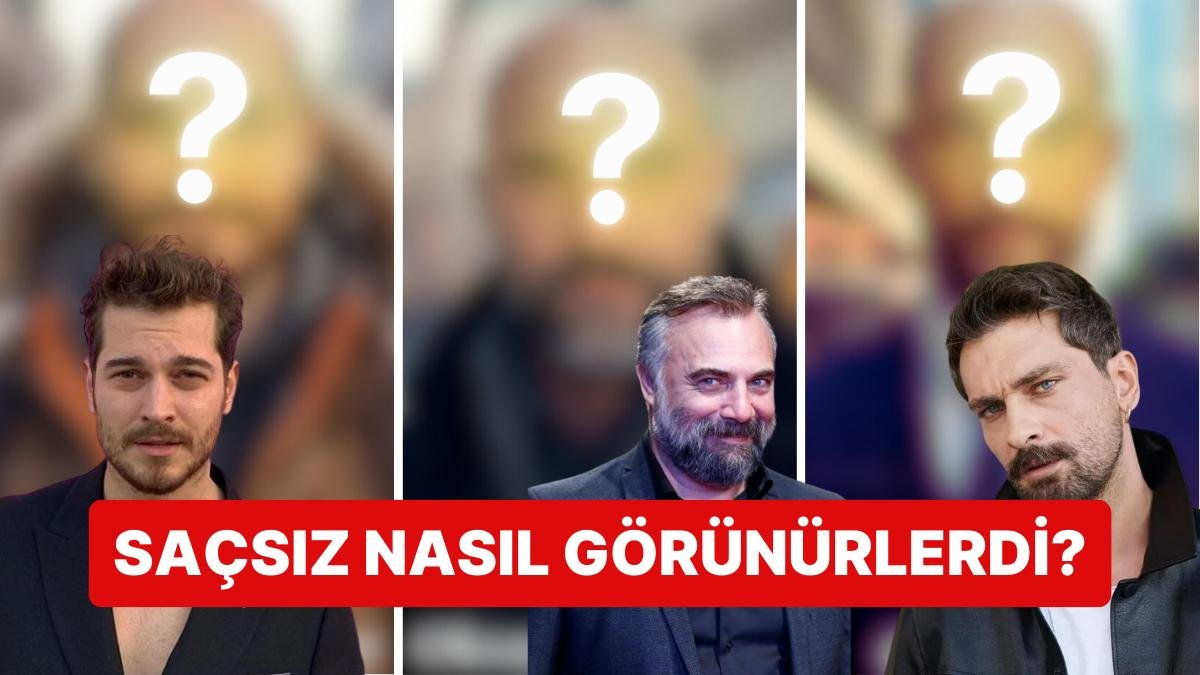 Oktay Kaynarca, Çağatay Ulusoy, Onur Tuna… Yakışıklı Oyuncular Kel Olsaydı Nasıl Görünürdü?