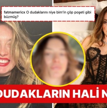 Makyajsız Doğal Halini Paylaşan Melis Sezen’in Dudak Estetiği “Doğallığın Bundan Haberi Var mı?” Dedirtti
