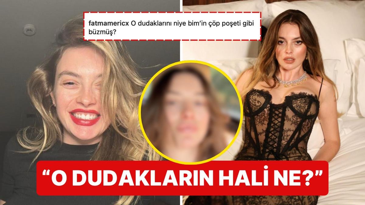 Makyajsız Doğal Halini Paylaşan Melis Sezen’in Dudak Estetiği “Doğallığın Bundan Haberi Var mı?” Dedirtti