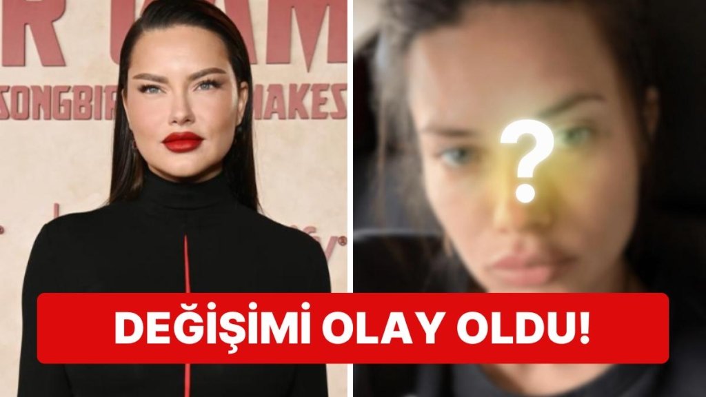 Son Çare Estetiğe mi Başvurdu? Doğum Sonrası Kilolarıyla Gündemde Olan Adriana Lima’nın Değişimi Şoke Etti