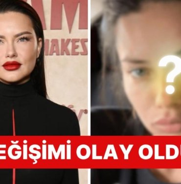 Son Çare Estetiğe mi Başvurdu? Doğum Sonrası Kilolarıyla Gündemde Olan Adriana Lima’nın Değişimi Şoke Etti