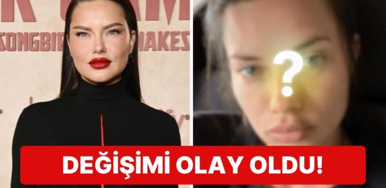 Son Çare Estetiğe mi Başvurdu? Doğum Sonrası Kilolarıyla Gündemde Olan Adriana Lima’nın Değişimi Şoke Etti