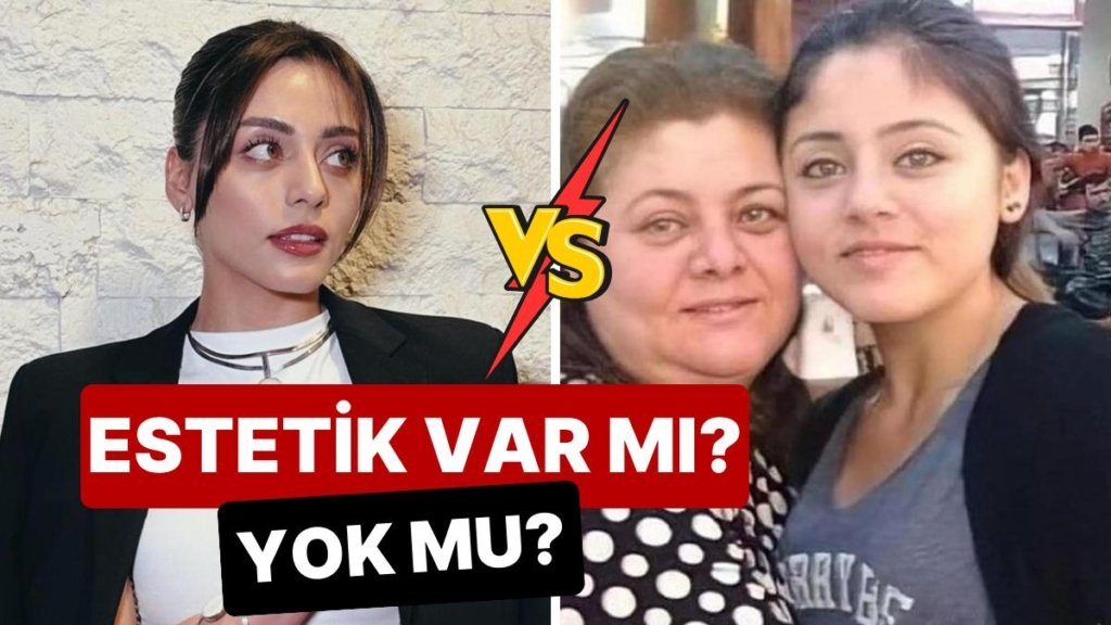 “Estetiğim Yok” Diyen Kızılcık Şerbeti’nin Doğa’sı Sıla Türkoğlu’nun Eski ve Yeni Hali Mercek Altına Alındı!
