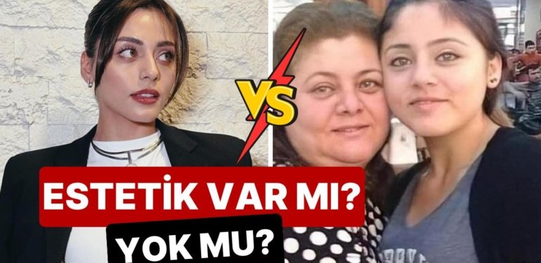 “Estetiğim Yok” Diyen Kızılcık Şerbeti’nin Doğa’sı Sıla Türkoğlu’nun Eski ve Yeni Hali Mercek Altına Alındı!