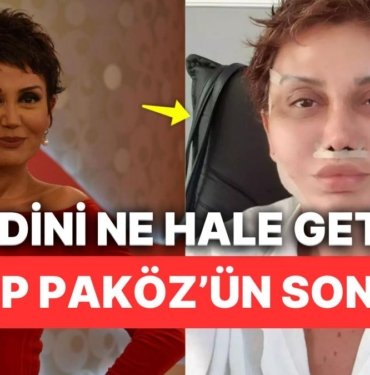 Serap Paköz’ü Yaptırdığı Estetiklerden Sonra Neredeyse Tanıyamıyorduk!