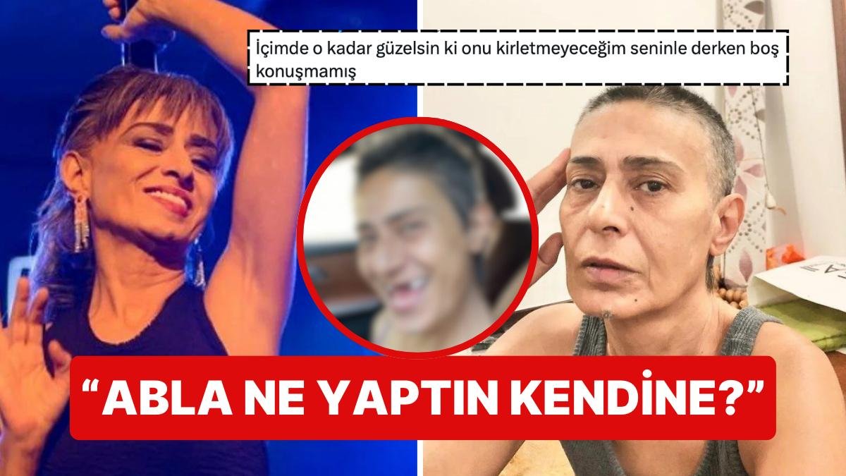 İmplant Tedavisi Gören Yıldız Tilbe’nin Dişsiz Fotoğrafları “Bu Kadar Özgüvenim Olsa Yeter” Dedirtti