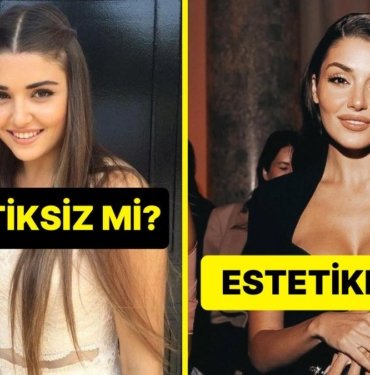 Bu Ünlülerin Estetikli Hali mi Yoksa Estetiksiz Hali mi Daha Güzel?