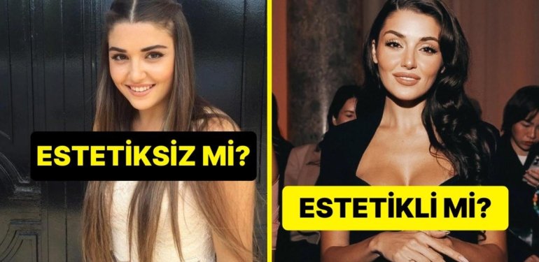 Bu Ünlülerin Estetikli Hali mi Yoksa Estetiksiz Hali mi Daha Güzel?