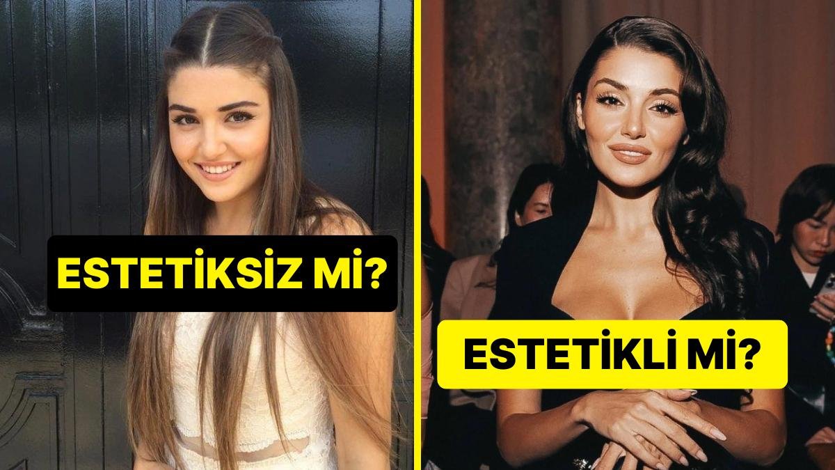 Bu Ünlülerin Estetikli Hali mi Yoksa Estetiksiz Hali mi Daha Güzel?