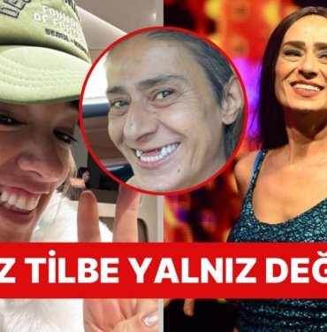 Yıldız Tilbe’nin Dişsiz Fotoğrafının Üstüne Diş Doktorundan Paylaşım Yapan Seda Bakan: “Yalnız Değilsin” Dedi