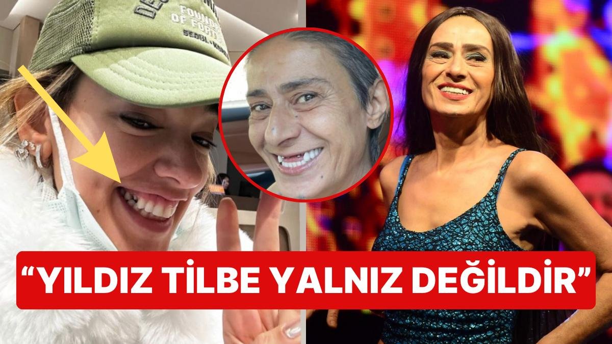 Yıldız Tilbe’nin Dişsiz Fotoğrafının Üstüne Diş Doktorundan Paylaşım Yapan Seda Bakan: “Yalnız Değilsin” Dedi