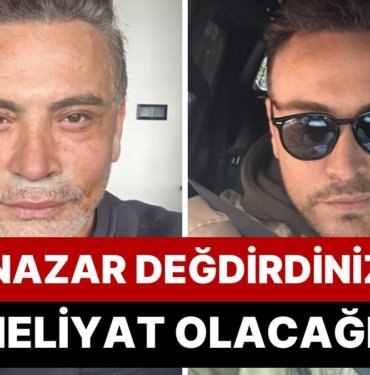 Yüzünü Gerdirdikten Sonra Poz Kesmelere Doyamayan Cenk Eren, Aksilik Çıktığı Gibi Suçu Eleştirenlere Attı!