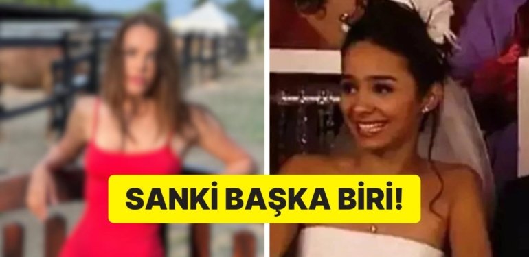 Akasya Durağı’nın Dilek’i Pelin Sönmez Değişimi ile Ağızları Açık Bıraktı!