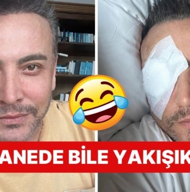 Tekrar Ameliyata Alınmıştı: Yüzüne Nazar Değen Cenk Eren Operasyondan Sonra Yine Kendini Beğenmeye Doyamadı