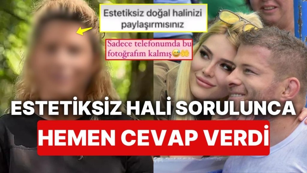 Eski Survivor Yarışmacısı İlayda Şeker “Estetiksiz Halini Paylaş” Mesajını Görünce Dayanamadı