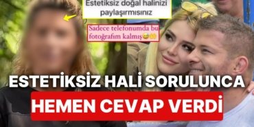 Eski Survivor Yarışmacısı İlayda Şeker “Estetiksiz Halini Paylaş” Mesajını Görünce Dayanamadı