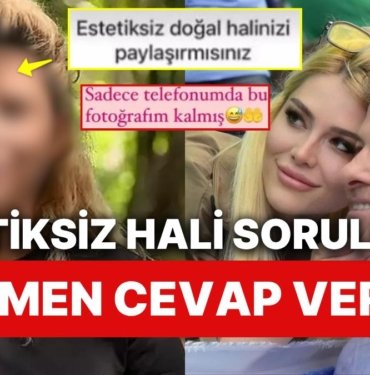 Eski Survivor Yarışmacısı İlayda Şeker “Estetiksiz Halini Paylaş” Mesajını Görünce Dayanamadı