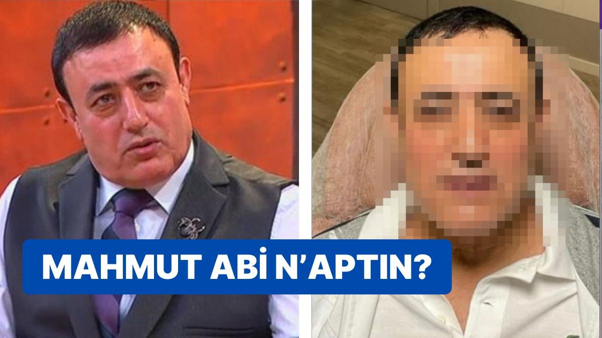 Halay Başkanı Mahmut Tuncer’in Estetikli Yeni Görüntüsü Sizi Çok Şaşırtacak