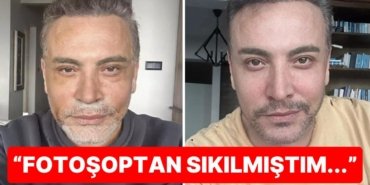 Biz Sadece Yüzünü Gerdirdi Zannediyorduk: Cenk Eren Yaptırdığı Estetikleri de Nedenini de Teker Teker Anlattı!