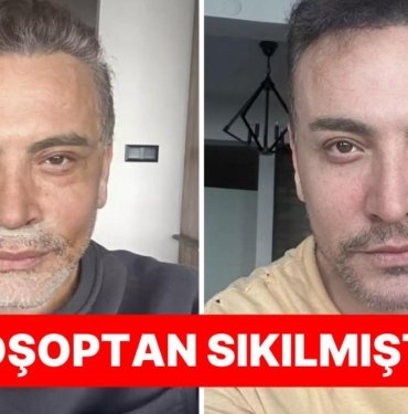 Biz Sadece Yüzünü Gerdirdi Zannediyorduk: Cenk Eren Yaptırdığı Estetikleri de Nedenini de Teker Teker Anlattı!