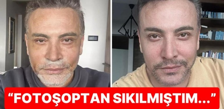 Biz Sadece Yüzünü Gerdirdi Zannediyorduk: Cenk Eren Yaptırdığı Estetikleri de Nedenini de Teker Teker Anlattı!
