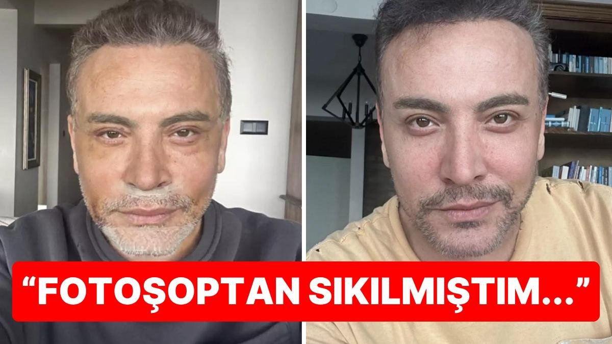 Biz Sadece Yüzünü Gerdirdi Zannediyorduk: Cenk Eren Yaptırdığı Estetikleri de Nedenini de Teker Teker Anlattı!