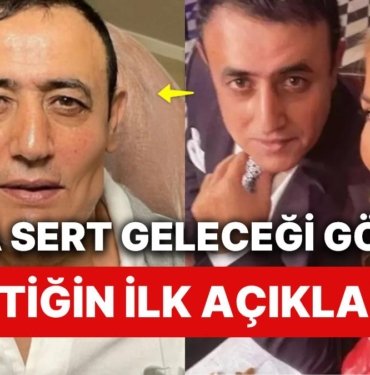 Yaptırdığı Estetikle Hepimizi Şoke Eden Mahmut Tuncer’den İlk Açıklama Geldi