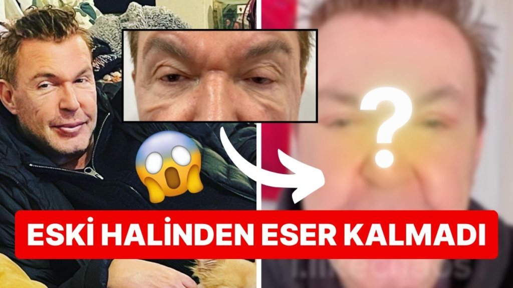 Estetikleriyle Adından Bahsettiren Kuşum Aydın Gözlerinden Geçirdiği Operasyonun Ardından Tanınmaz Hale Geldi