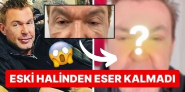 Estetikleriyle Adından Bahsettiren Kuşum Aydın Gözlerinden Geçirdiği Operasyonun Ardından Tanınmaz Hale Geldi