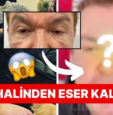 Estetikleriyle Adından Bahsettiren Kuşum Aydın Gözlerinden Geçirdiği Operasyonun Ardından Tanınmaz Hale Geldi
