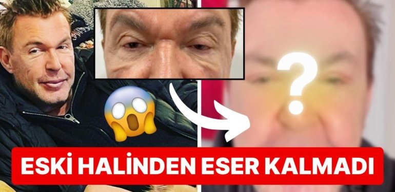 Estetikleriyle Adından Bahsettiren Kuşum Aydın Gözlerinden Geçirdiği Operasyonun Ardından Tanınmaz Hale Geldi