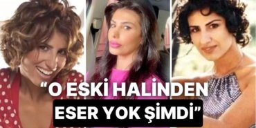 “Aile Gibi Yaşayalım Dedim Gerizekalı” Çıkışıyla Hafızalara Kazınan Hatice’nin Estetik Geçmişini İnceliyoruz!