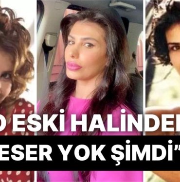 “Aile Gibi Yaşayalım Dedim Gerizekalı” Çıkışıyla Hafızalara Kazınan Hatice’nin Estetik Geçmişini İnceliyoruz!