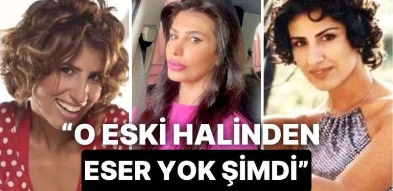 “Aile Gibi Yaşayalım Dedim Gerizekalı” Çıkışıyla Hafızalara Kazınan Hatice’nin Estetik Geçmişini İnceliyoruz!