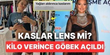 Aniden 11 Kilo Veren Demet Akalın Şov Yapar Gibi Göbeğini Açınca “Kaslar da mı Estetik?” Diye Düşündürttü