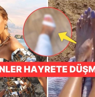 Çağla Şıkel’in Ayakları Diye Yayınlanan Görüntü Sonrası Ünlü Modelden Kanıt Niteliğinde Paylaşım!