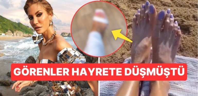 Çağla Şıkel’in Ayakları Diye Yayınlanan Görüntü Sonrası Ünlü Modelden Kanıt Niteliğinde Paylaşım!